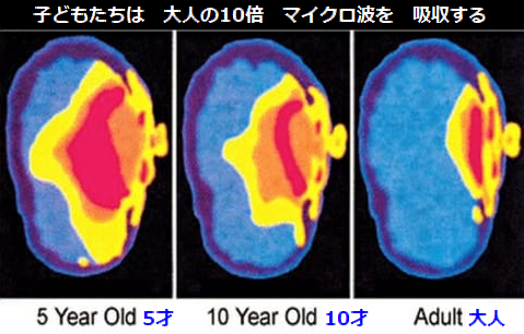 子どもの脳.png