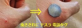 虫刺され電話タグ (1).jpg
