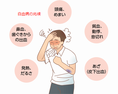condition_fig_01.png