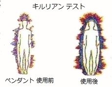 kirlian.jpg