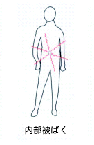 naibuhibaku.gif