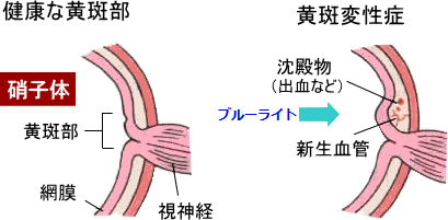 ouhan-3.gif