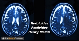 pesticide-brain.jpg