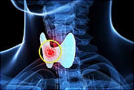 thyroid1.jpg